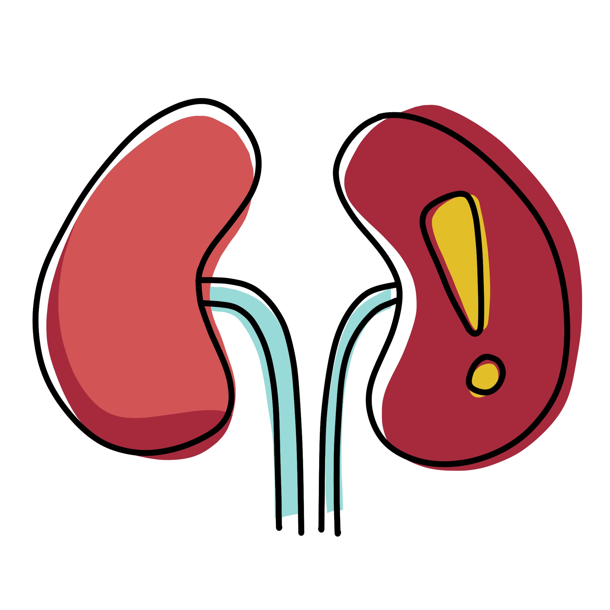 illustration of faulty kidneys