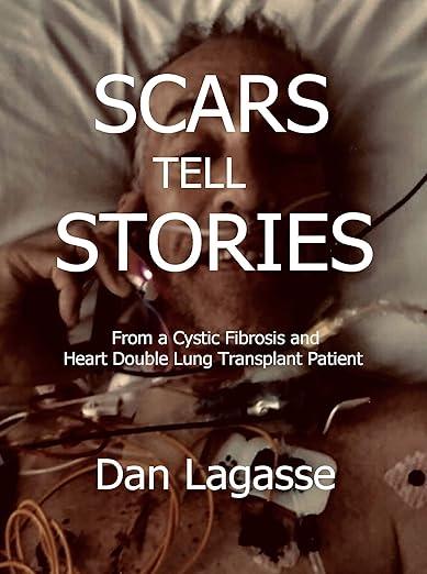 Scars Tell Stories  by Dan Lagasse